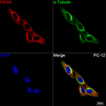PDXK Antibody in Immunocytochemistry (ICC/IF)