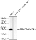 CD42a Antibody in Western Blot (WB)