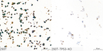 p53 Antibody in Immunocytochemistry (ICC/IF)