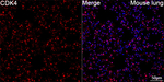 CDK4 Antibody in Immunocytochemistry (ICC/IF)