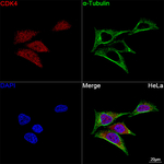 CDK4 Recombinant Rabbit Monoclonal Antibody (7X4W1)
