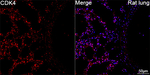 CDK4 Antibody in Immunohistochemistry (Paraffin) (IHC (P))