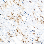 CDK4 Antibody in Immunohistochemistry (Paraffin) (IHC (P))