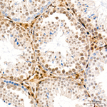 CDK4 Antibody in Immunohistochemistry (Paraffin) (IHC (P))