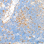 CDK4 Antibody in Immunohistochemistry (Paraffin) (IHC (P))