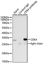 CDK4 Antibody in Immunoprecipitation (IP)