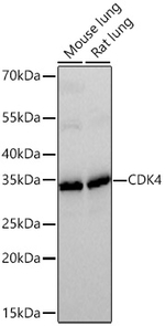 CDK4 Antibody in Western Blot (WB)