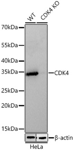 CDK4 Antibody in Western Blot (WB)