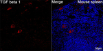 TGF beta-1 Recombinant Rabbit Monoclonal Antibody (10X3C4)