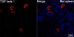 TGF beta-1 Antibody in Immunohistochemistry (Paraffin) (IHC (P))