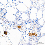 TGF beta-1 Antibody in Immunohistochemistry (Paraffin) (IHC (P))