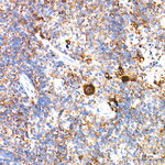 TGF beta-1 Antibody in Immunohistochemistry (Paraffin) (IHC (P))