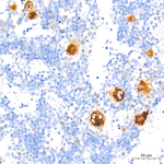 TGF beta-1 Antibody in Immunohistochemistry (Paraffin) (IHC (P))