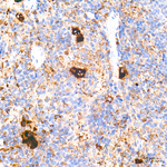 TGF beta-1 Antibody in Immunohistochemistry (Paraffin) (IHC (P))