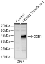 HOXB1 Recombinant Rabbit Monoclonal Antibody (7N7Y8)