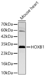HOXB1 Antibody in Western Blot (WB)