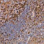 alpha Actinin 1 Recombinant Rabbit Monoclonal Antibody (4J4F3)