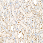 TLE2 Recombinant Rabbit Monoclonal Antibody (8X9P4)