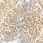 TLE2 Antibody in Immunohistochemistry (Paraffin) (IHC (P))