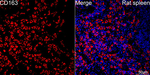 CD163 Antibody in Immunohistochemistry (Paraffin) (IHC (P))