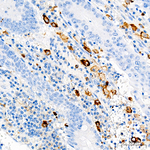 CD163 Antibody in Immunohistochemistry (Paraffin) (IHC (P))