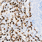 CD163 Antibody in Immunohistochemistry (Paraffin) (IHC (P))