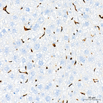 CD163 Antibody in Immunohistochemistry (Paraffin) (IHC (P))