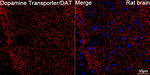 Dopamine Transporter Antibody in Immunohistochemistry (Paraffin) (IHC (P))