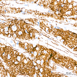 Dopamine Transporter Antibody in Immunohistochemistry (Paraffin) (IHC (P))