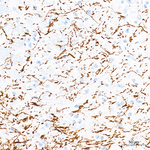 Dopamine Transporter Antibody in Immunohistochemistry (Paraffin) (IHC (P))
