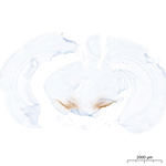 Dopamine Transporter Antibody in Immunohistochemistry (Paraffin) (IHC (P))