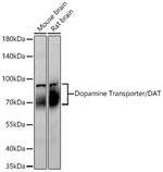 Dopamine Transporter Antibody in Western Blot (WB)