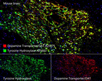 Dopamine Transporter Antibody in Multiplex Immunohistochemistry (mIHC)