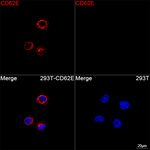 E-selectin Recombinant Rabbit Monoclonal Antibody (8U1K1)