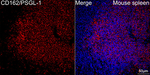 CD162 Antibody in Immunohistochemistry (Paraffin) (IHC (P))