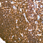 CD162 Antibody in Immunohistochemistry (Paraffin) (IHC (P))