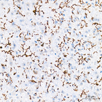CD162 Antibody in Immunohistochemistry (Paraffin) (IHC (P))