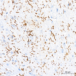CD162 Antibody in Immunohistochemistry (Paraffin) (IHC (P))