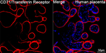 CD71 Antibody in Immunohistochemistry (Paraffin) (IHC (P))