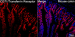 CD71 Antibody in Immunohistochemistry (Paraffin) (IHC (P))
