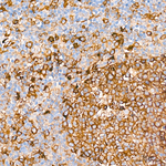 CD71 Antibody in Immunohistochemistry (Paraffin) (IHC (P))