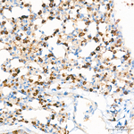 CD71 Antibody in Immunohistochemistry (Paraffin) (IHC (P))