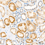 ACAA2 Antibody in Immunohistochemistry (Paraffin) (IHC (P))