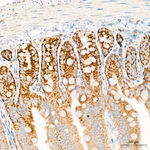 ACAA2 Antibody in Immunohistochemistry (Paraffin) (IHC (P))