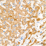 ACAA2 Antibody in Immunohistochemistry (Paraffin) (IHC (P))