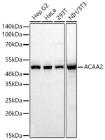 ACAA2 Antibody in Western Blot (WB)