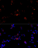 CD79b Recombinant Rabbit Monoclonal Antibody (7C5Q1)