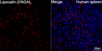NGAL Antibody in Immunohistochemistry (Paraffin) (IHC (P))