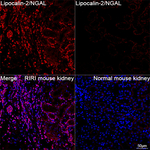 NGAL Recombinant Rabbit Monoclonal Antibody (8O9J8)