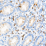 NGAL Antibody in Immunohistochemistry (Paraffin) (IHC (P))